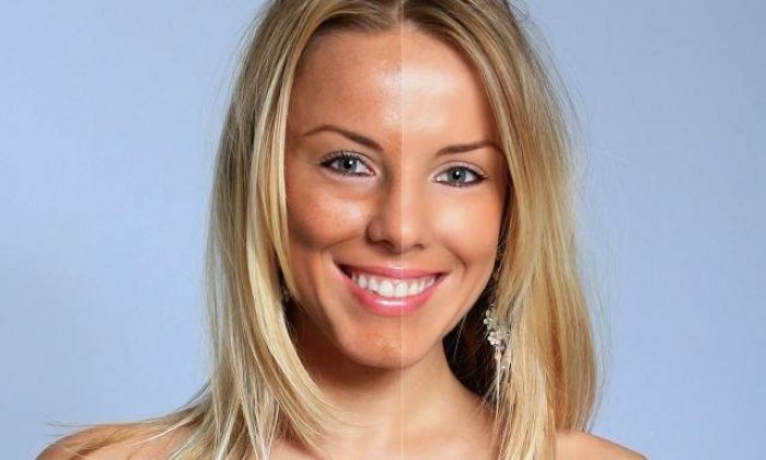 Soğuk havada egzamadan korunma