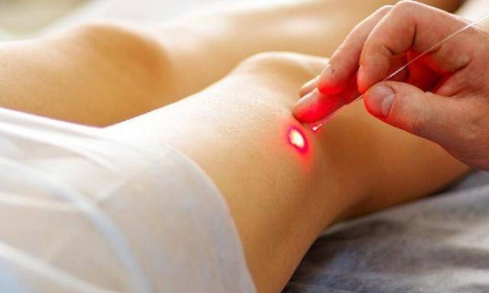 Türk firma varis ameliyatında dünya tıp tarihine geçti